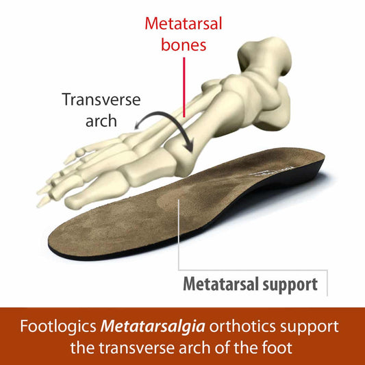 Footlogics Metatarsalgia Insole Full Length